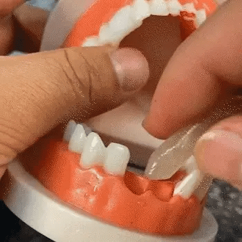 Kit de Reparación Dental Temporal: Recupera tu Sonrisa al Instante ✨🦷